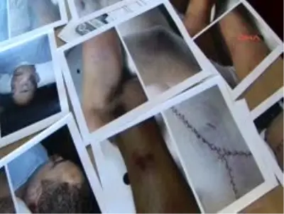 Hollanda'da Karakolda Ölen Türk Gencinin Ek Otopsi Raporu Şok Etkisi Yarattı Hollanda'da Karakolda Ölen Türk Gencinin Ek Otopsi Raporu Şok Etkisi Yarattı