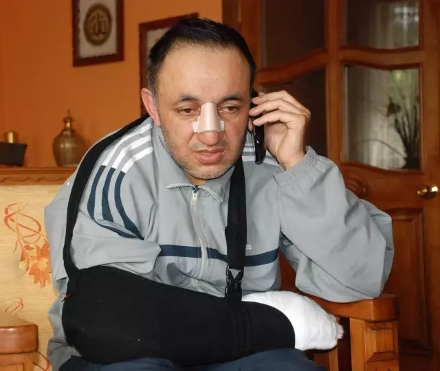 Burnu ve Parmağı Kırılan Doktor, İki Ayrı Ameliyat Geçirdi