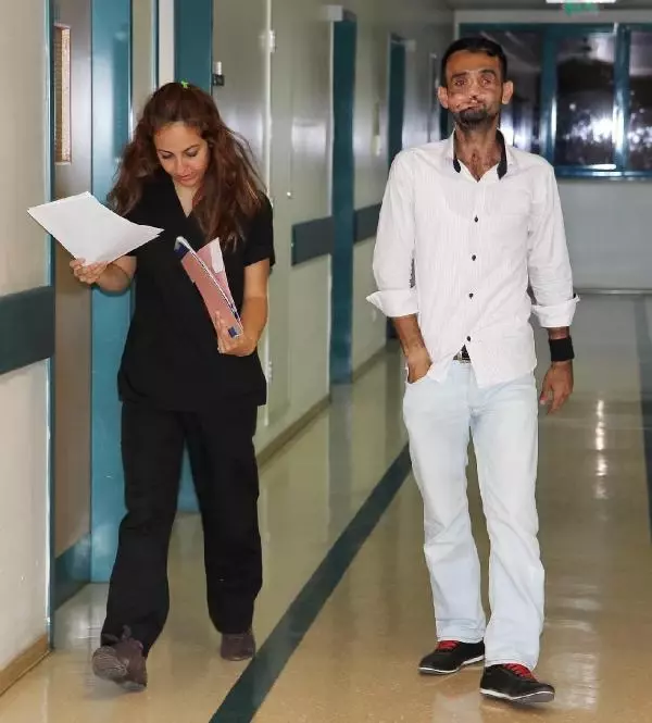 Yüz Nakli Yapılan Recep Sert�in Sağlık Durumu İyi Haberler