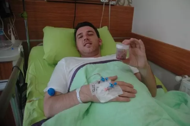 Kosovalı Gencin Böbreğinden Bir Kavanoz Taş Çıktı Kosovalı Gencin Böbreğinden Bir Kavanoz Taş Çıktı