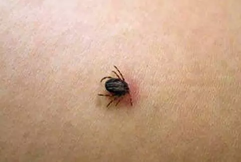 Samsun'da Kene Şüphesiyle Ölüm Samsun'da Kene Şüphesiyle Ölüm