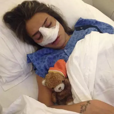 Güzel Oyuncu Ceyda Ateş'in Burnu Kırıldı Güzel Oyuncu Ceyda Ateş'in Burnu Kırıldı
