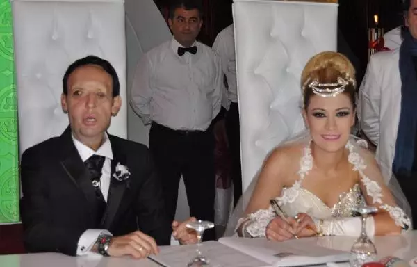 Yüz Nakilli Recep Sert'in Düğünü Öncesi Kına Gecesinde Mutluluk Gözyaşları (2)