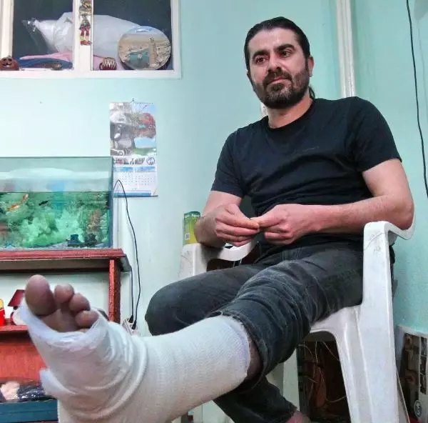 'Öğle Mesaisinde Yemekteyim' Diyen Doktorun Ayağını Kırdılar