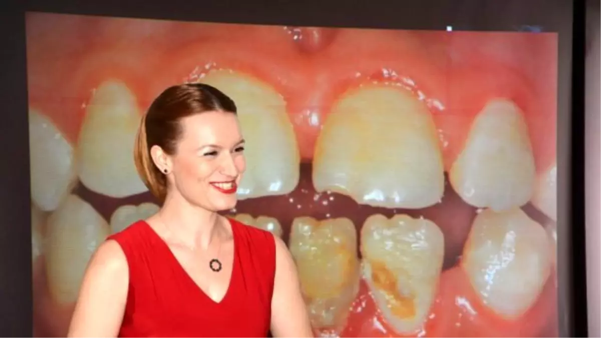 Esra Karaca Uyku Programini Anlatiyor In Misil Misil Uyku Uyeleri Anlatiyor On Vimeo