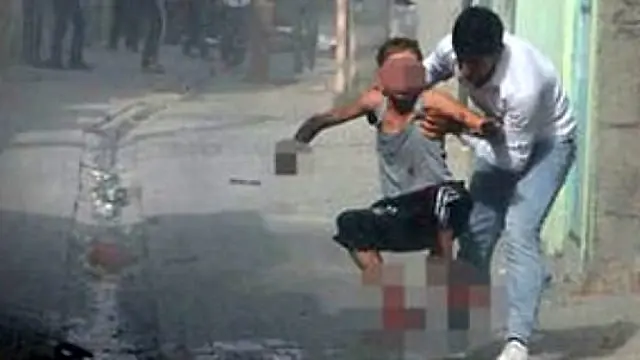Cizre'de Patlayan Bomba, 12 Yaşındaki Çocuğun Hayatını Kararttı Cizre'de Patlayan Bomba, 12 Yaşındaki Çocuğun Hayatını Kararttı