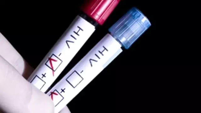 Fransa�da Evde AIDS Testi Satışa Çıktı Haberler