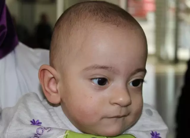 Yaşamaz Denilen Parmak Bebek 10 Aylık Oldu Yaşamaz Denilen Parmak Bebek 10 Aylık Oldu