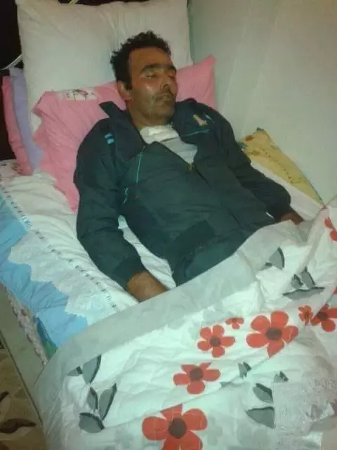 Çamaşır Suyundan Zehirlenen Gelin 5 Aydır Komada Çamaşır Suyundan Zehirlenen Gelin 5 Aydır Komada