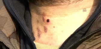 Boynundan Yaralanan 'Özel Harekatçı' Eve Dönmeyi Kabul Etmedi