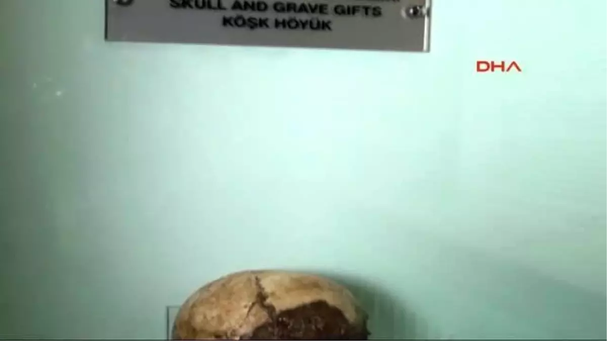 Niğde Müzedeki 7 Bin 200 Yıllık Kafatası Büyük İlgi Görüyor