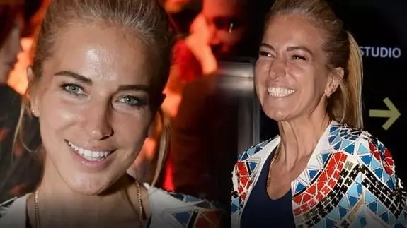 Burcu Esmersoy'un Saçları Beyazladı