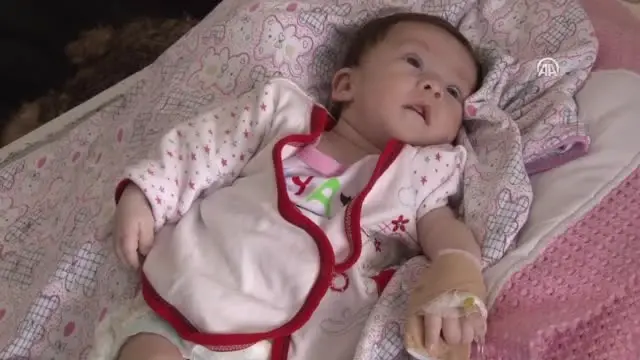 bir aylik bebegin kalbindeki delik ameliyatsiz kapatildi haberler haberler com