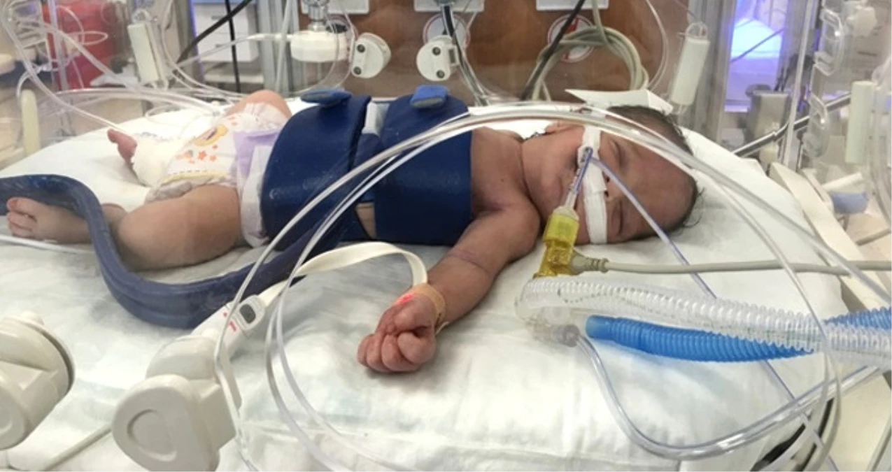Gaziantep'te Özel Hastanede Doğum Skandalı! Yeni Doğan Bebeğin Beyninde Hasar Oluştu