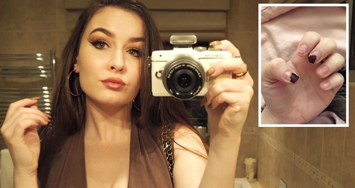 Takma Tırnak Bağımlısı Kadın, Ellerini Kullanamaz Hale Geldi