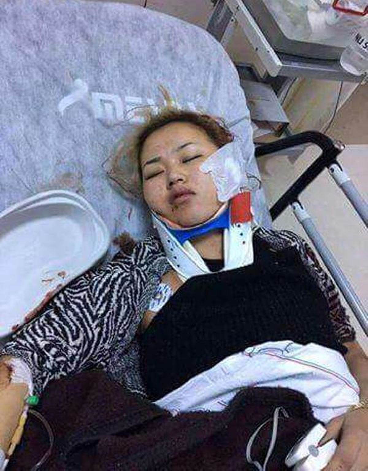 Antalya'da Yabancı Uyruklu Kadını Dövüp, Yol Kenarına Attılar
