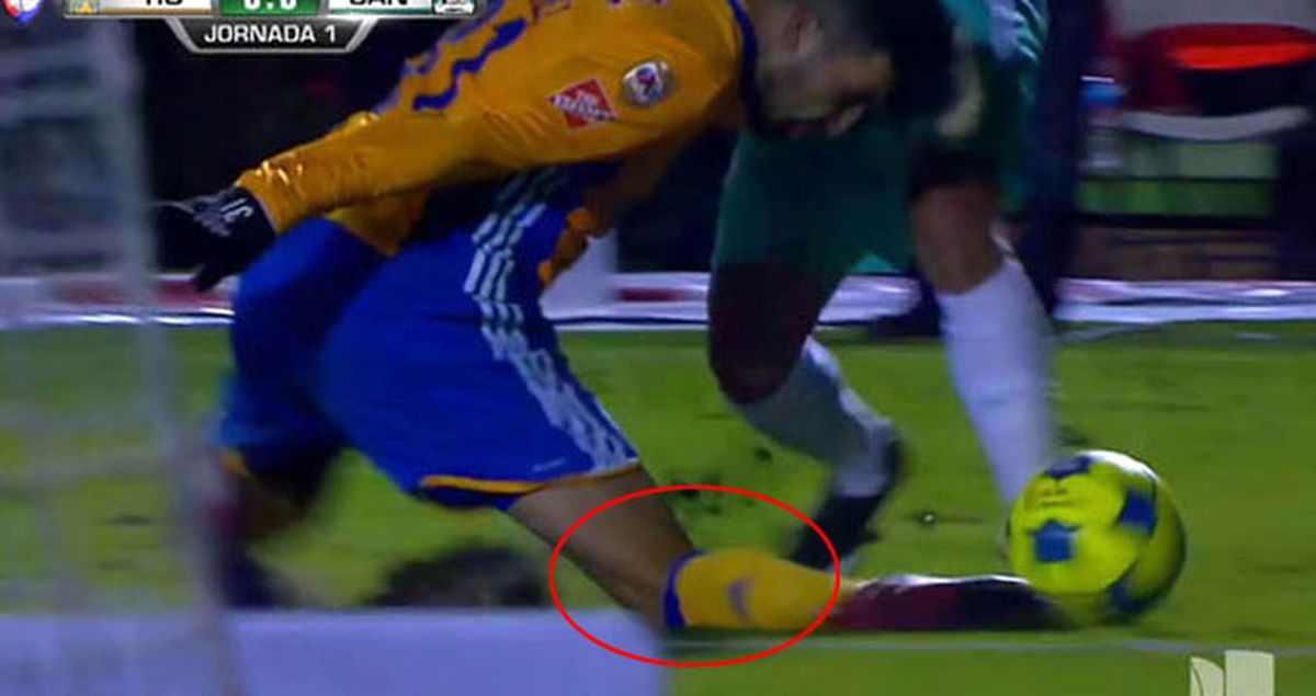 Tigres Forması Giyen Luis Martinez'in Ayağı Feci Şekilde Kırıldı