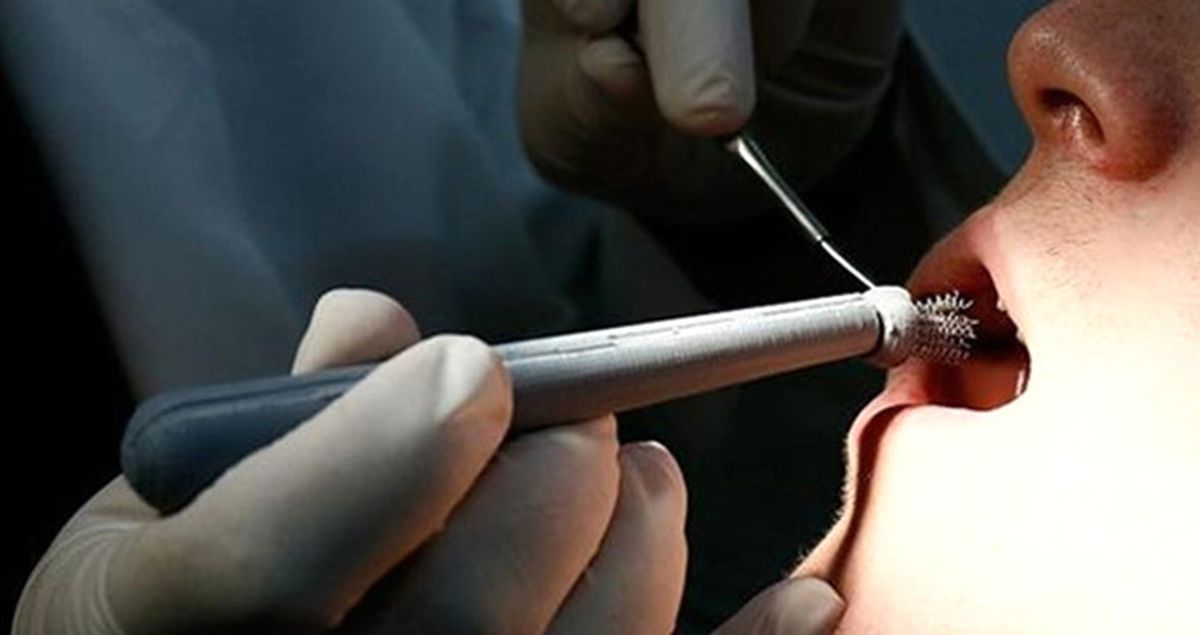 Ağız Kanserine Karşı 'Türk Fırçası'nı Geliştirdiler