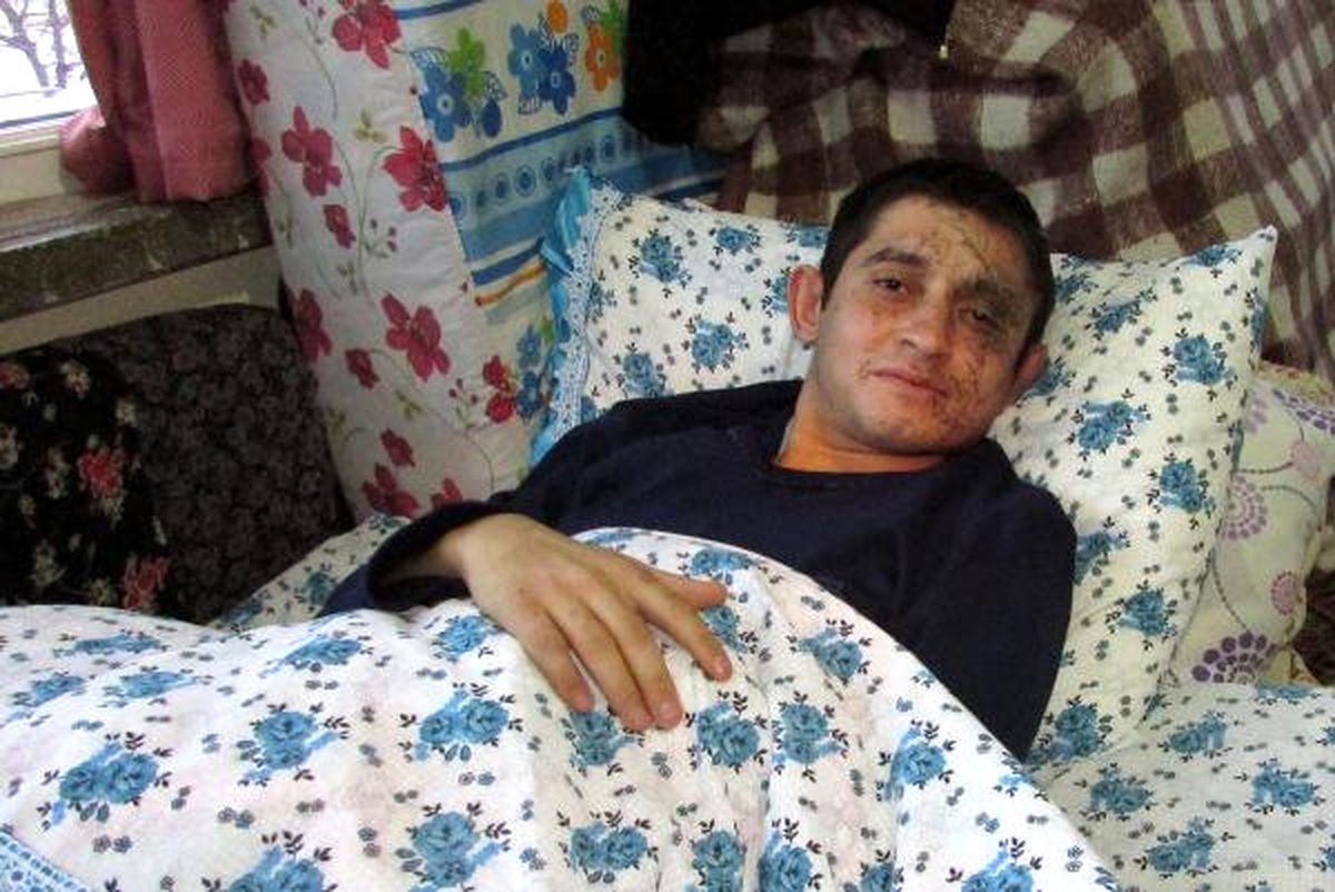 Kayseri'deki Hain Saldırıda Yararlanan Er: Geçici Görme Kaybı Yaşadım
