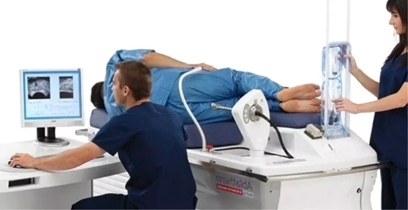 Prostat Kanserinde Modern Robotik Tedavi Yöntemi Hıfu Nedir?