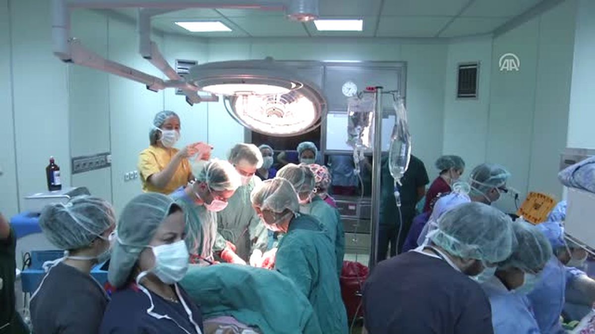 Yapışık Ikizler Tek Karaciğerle Dünyaya Geldi