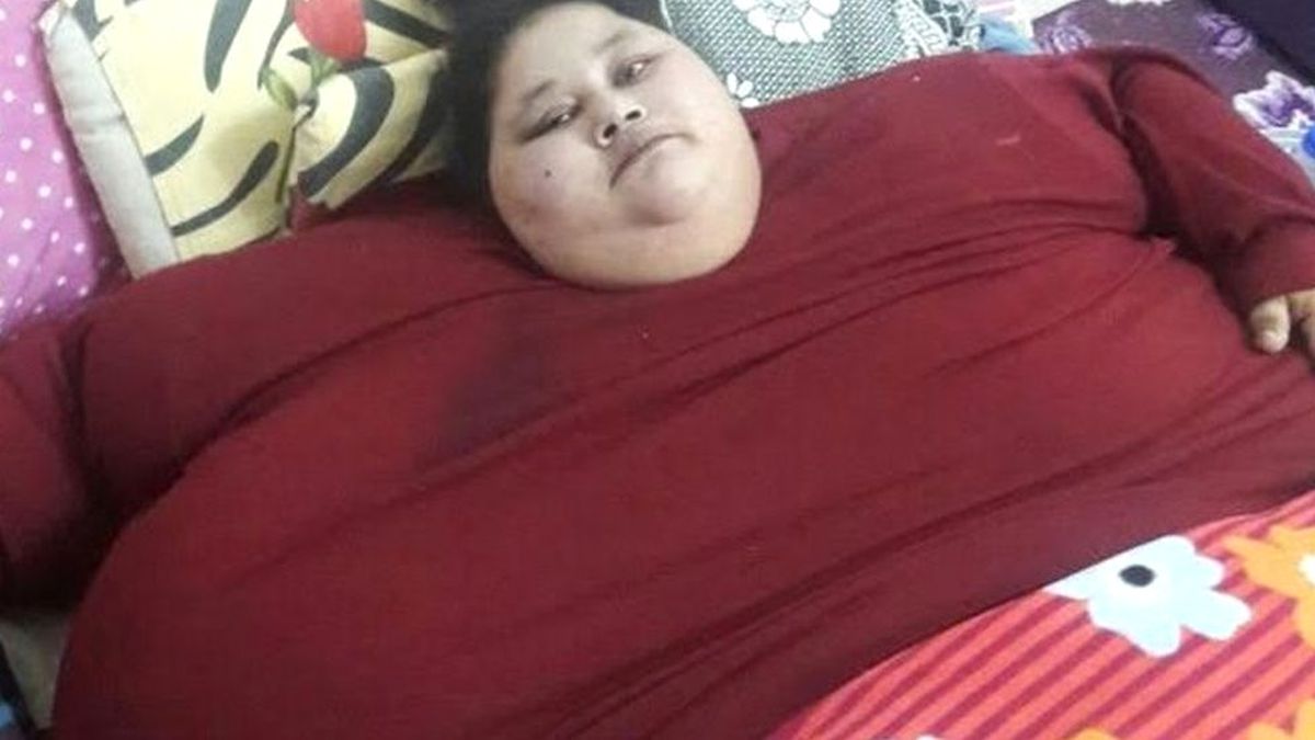 'Dünyanın En Kilolu Kadını' Mide Ameliyatı İçin Hindistan'a Getirildi