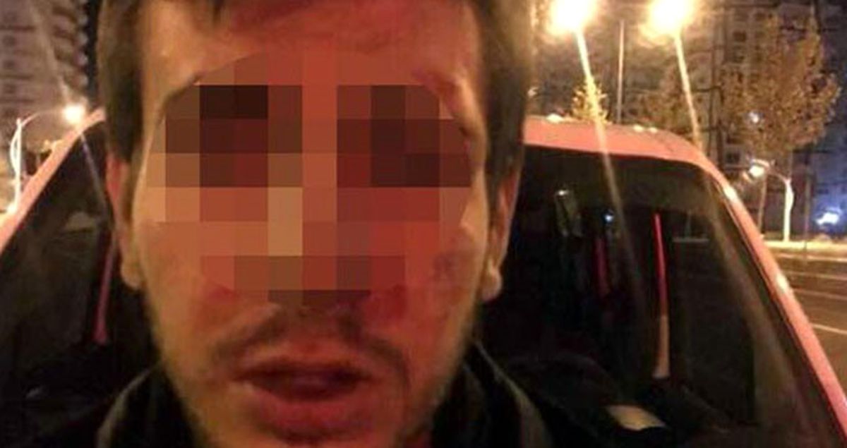 Şişeye Oturtma Girişiminin 'Hakaret' Suçu Sayılmasına İtiraz Edildi