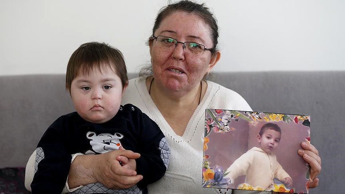 Anne Down Sendromlu Oğlunu Yaşatmak İstiyor