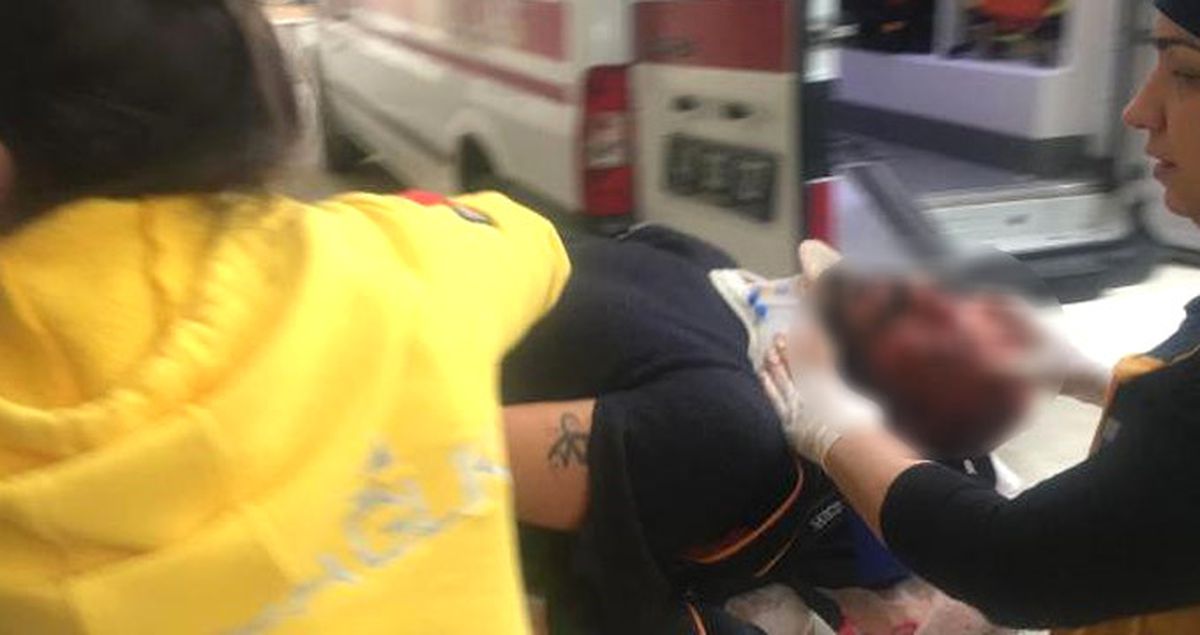 Köpeğini Polislerin Üzerine Salarak Kaçan Şüpheli Başından Vuruldu