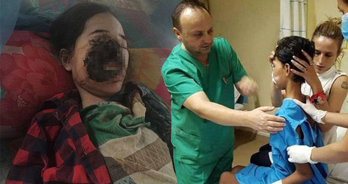 Kamboçya'da Genç Kız Dişçiye Gitti, Yüzünün Yarısını Kaybetti!