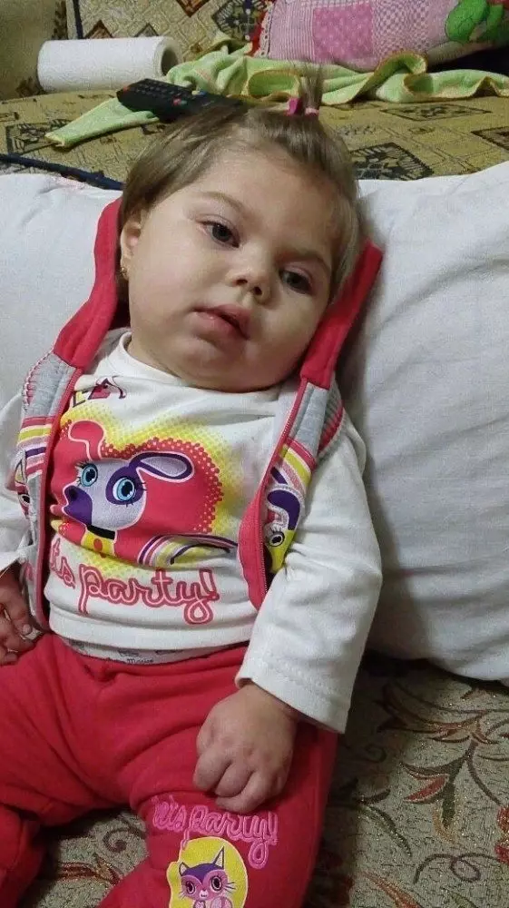 Görme, Konuşma ve Yürüme Yetisini Kaybeden Berre Bebek