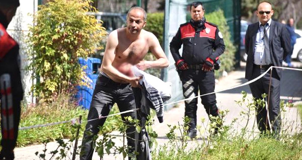 Dişlerini Tedavi Ettiremeyen Adam, Hastane Bahçesinde Kendini Kesti
