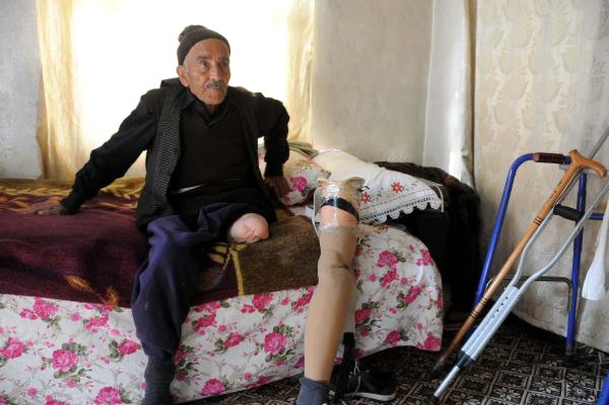 SGK, 74 Yaşındaki Protez Bacaklı Vatandaşa 'Çalışabilir' Raporu Verdi