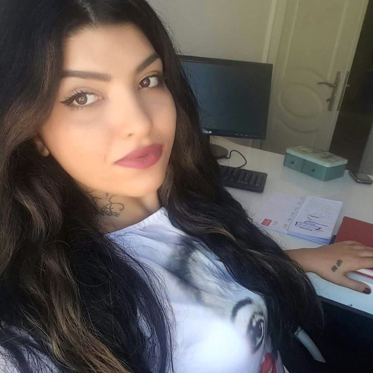 Antalya'da Otomobilin Önüne Atlayan Genç Kızın Durumu İyiye Gidiyor