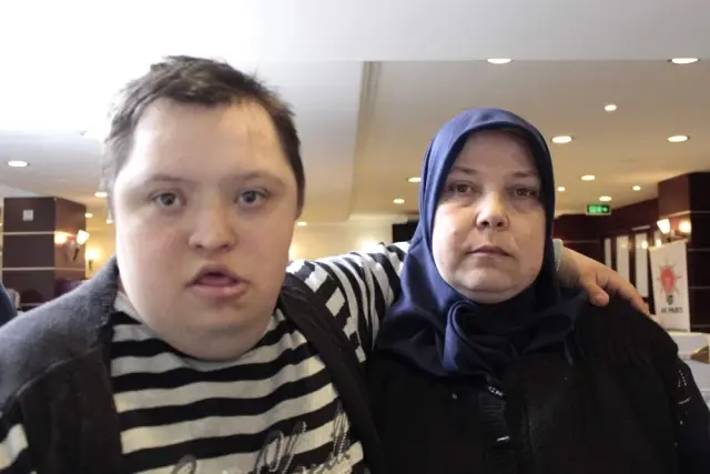 Down Sendromlu Annenin Tek Sıkıntısı Sokaktaki İnsanların Bakışları