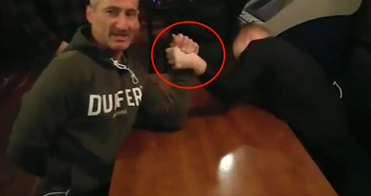 Bilek Güreşi Yapan Kişi, Ters Hareketiyle Kendi Bileğini Kırdı