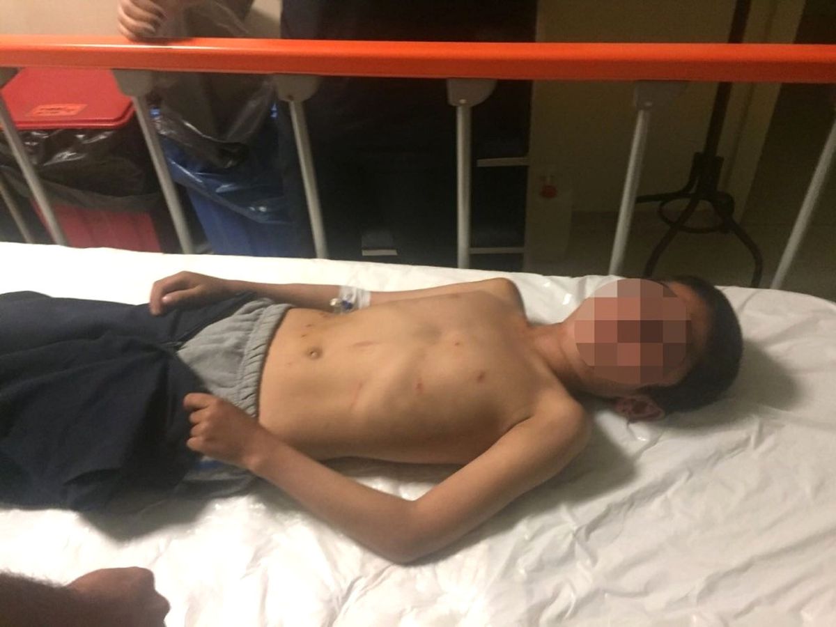 Adana'da Pazar Yerinde Silahlar Konuştu: 6 Yaralı