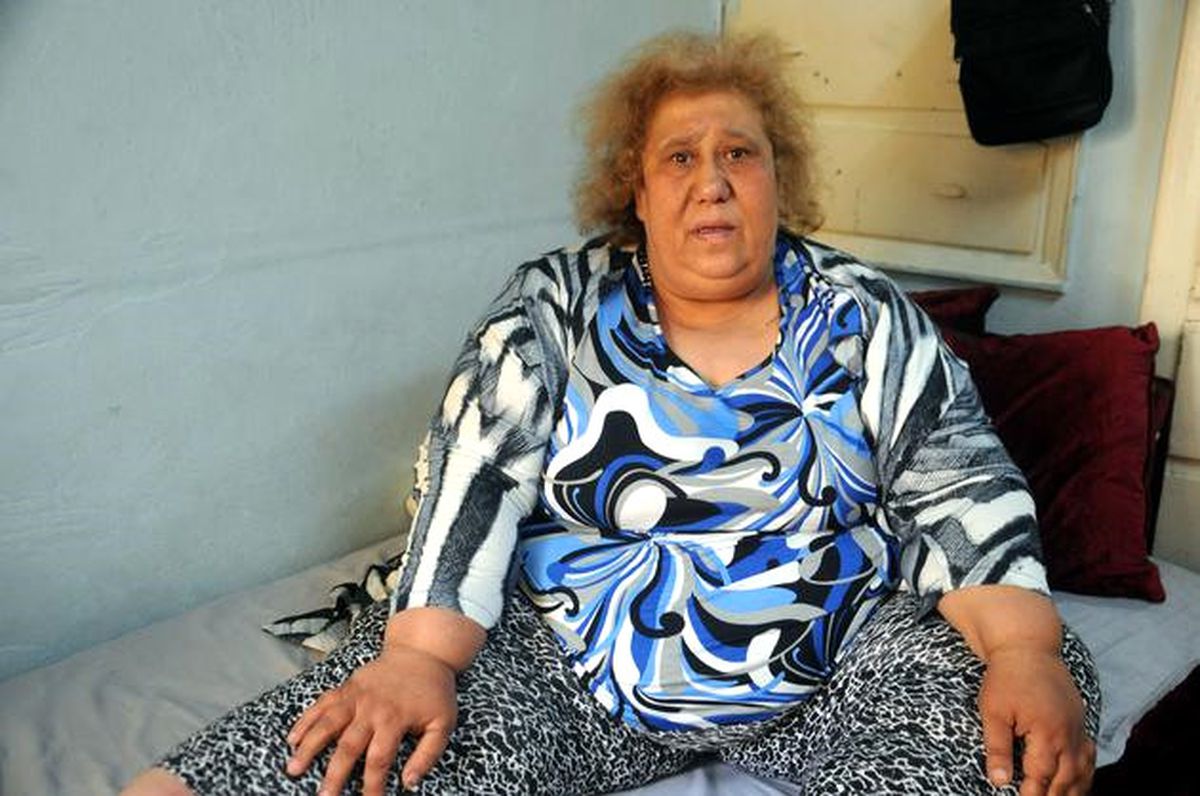 185 Kiloluk Kadın Erdoğan'dan Yardım İstedi