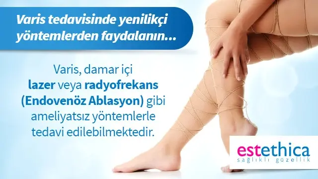Vücuttaki çatlaklar önlenebilir mi Vücuttaki çatlaklar önlenebilir mi