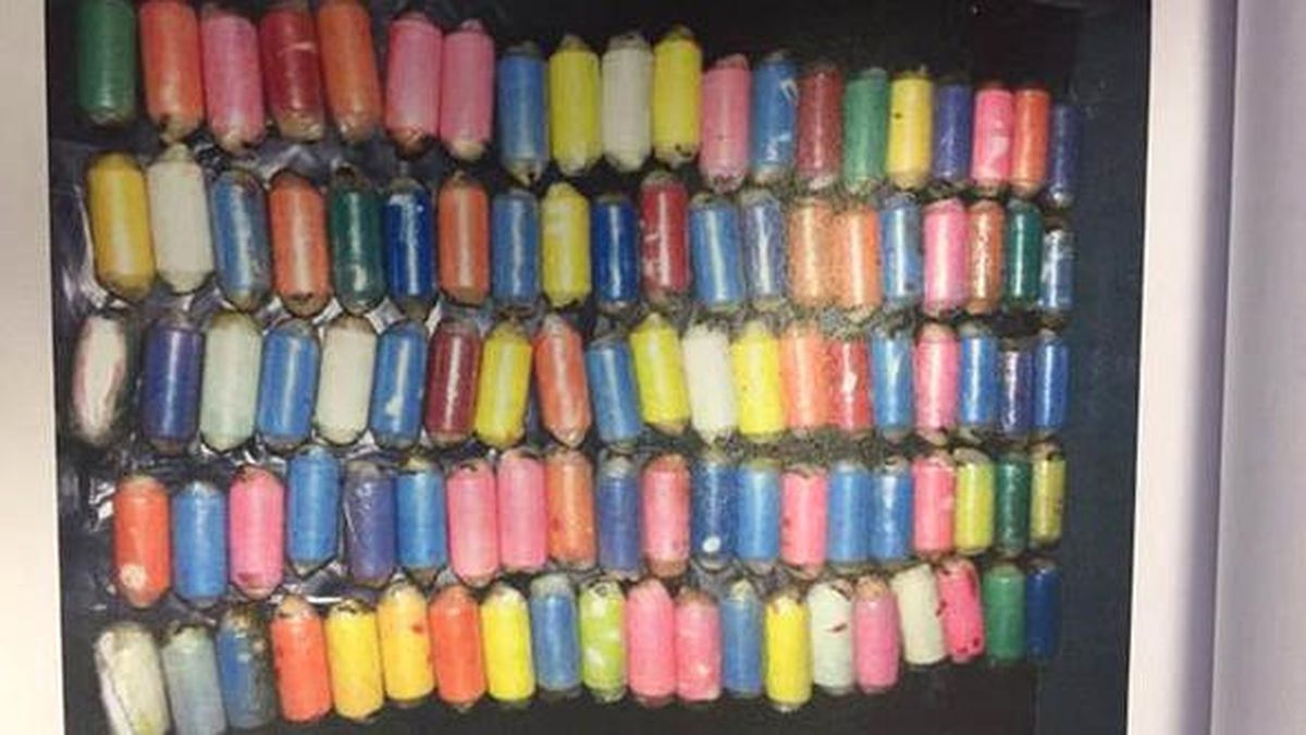 Midesinden 82 Kapsül Kokain Çıkan Ukraynalıya 45 Yıl Hapis İstemi