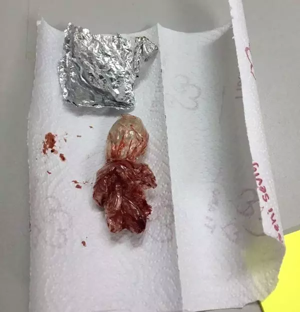 Eroini Cinsel Organına Saklamış