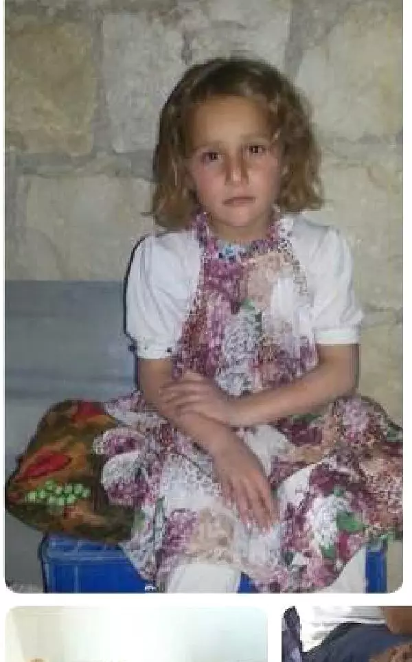 Suriyeli Minik Ayşe'nin Sağlığına Kavuşmak İstiyor