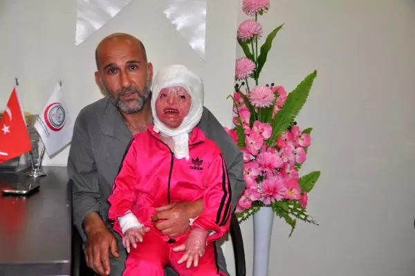 Suriyeli Minik Ayşe'nin Sağlığına Kavuşmak İstiyor