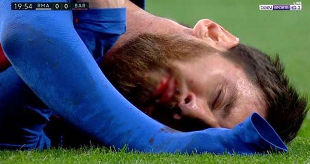 Barcelona'da forma giyen Messi, Rakibinden Dirsek Yiyince Dudağı Patladı