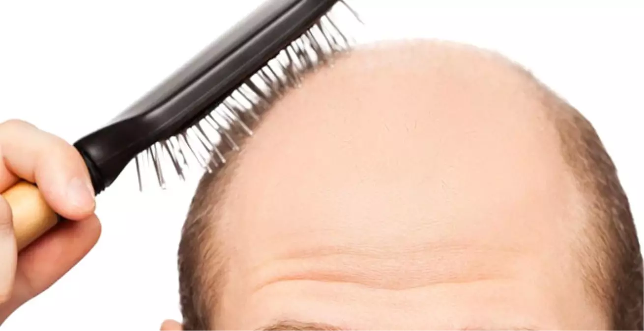 Seyrek Saçlı Erkekler Nasıl Saç Kesim Yapmalı?