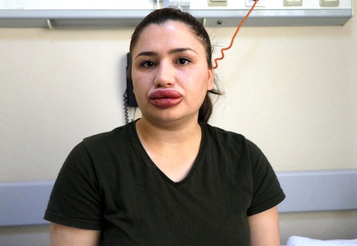 'Doktor' Sandığı Kuaföre Dolgu Yaptıran Fatma Hemşire: Çok Pişmanım