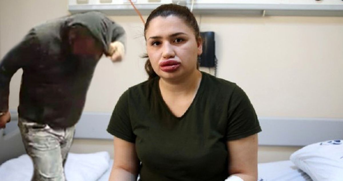 Merve Hemşire'nin Hayatını Karartan Kuaför, Hırsızlıktan Tutuklandı