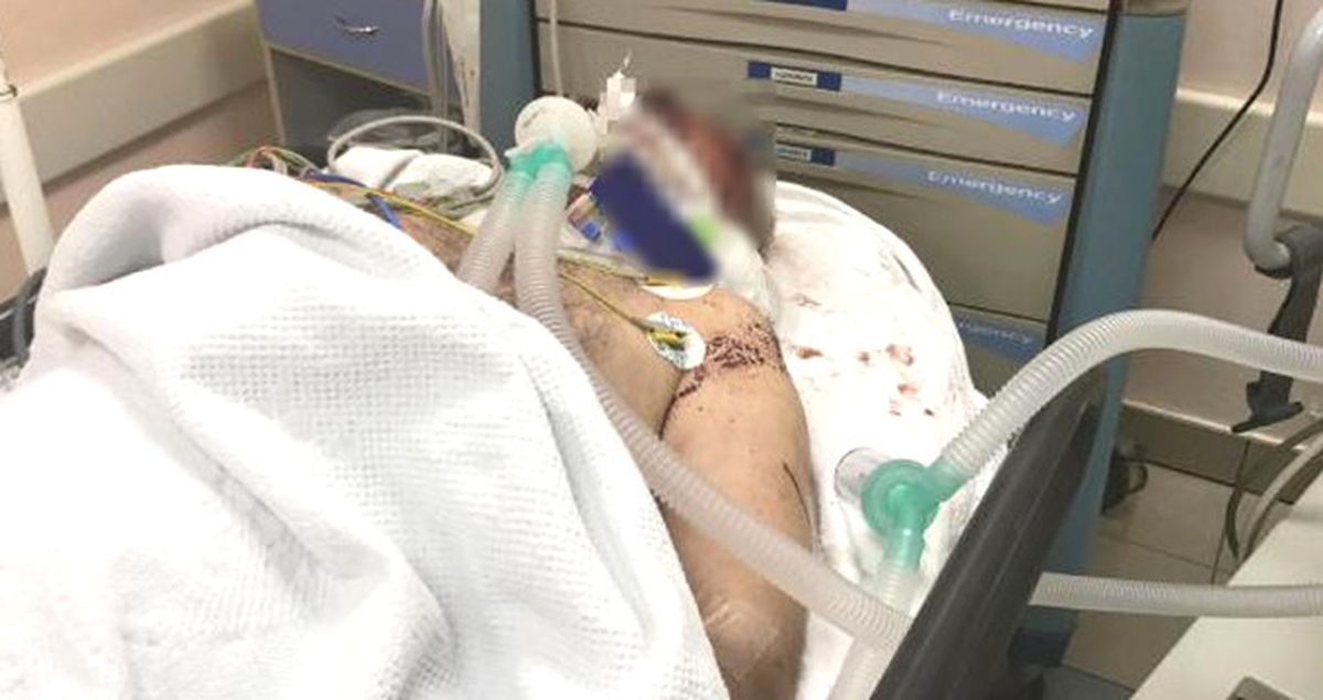 Kocaeli'nde Vahşet! Önce Bıçakladılar, Sonra Makatına Yalıtım Köpüğü Sıktılar