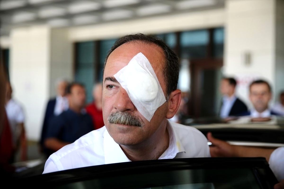 Edirne Belediye Başkanı Recep Gürkan'a Saldıran Görkem Huslu Tutuklandı
