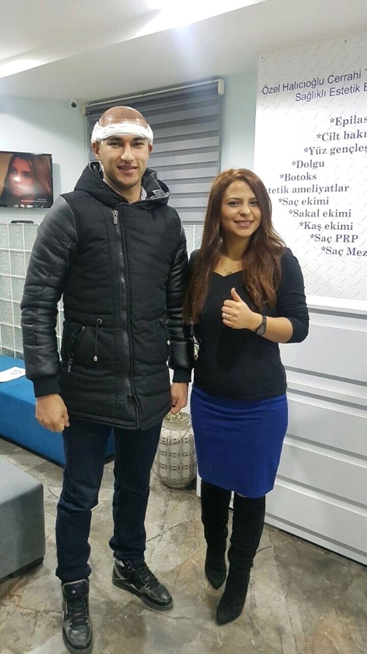 Yaz Ayına Saç Problemi ile Girmeyin